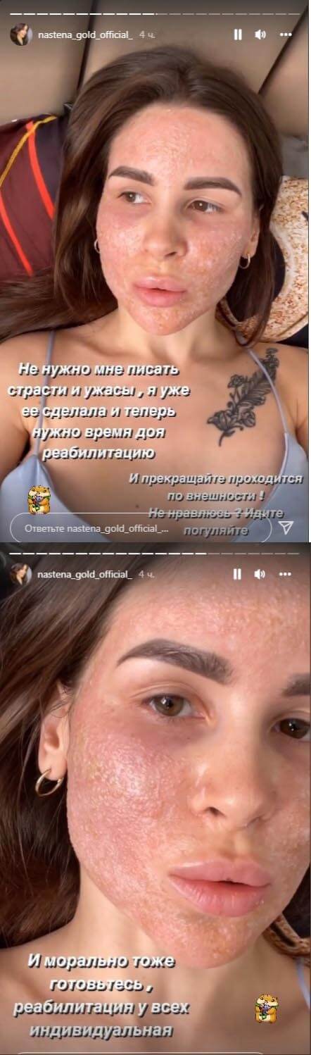 Обсуждение фото Анастасии Голд вконтакте Обсуждение фото Анастасии Голд вконтакте