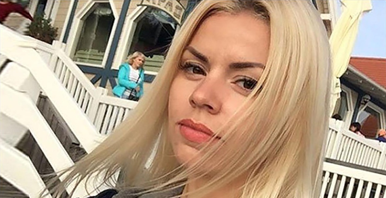 Оксана Стрункина показала себя после круговой подтяжки лица  фото