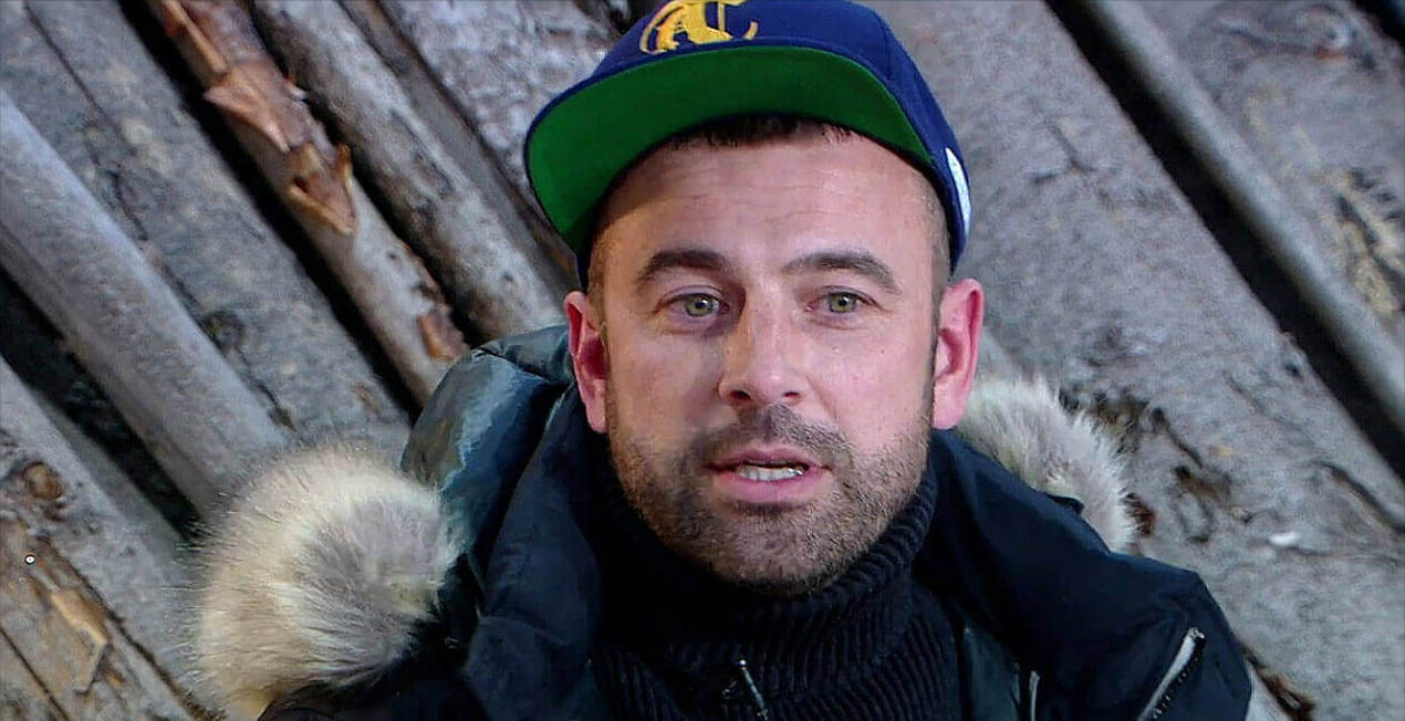 Алексей Адеев помолодел после пластики лица.