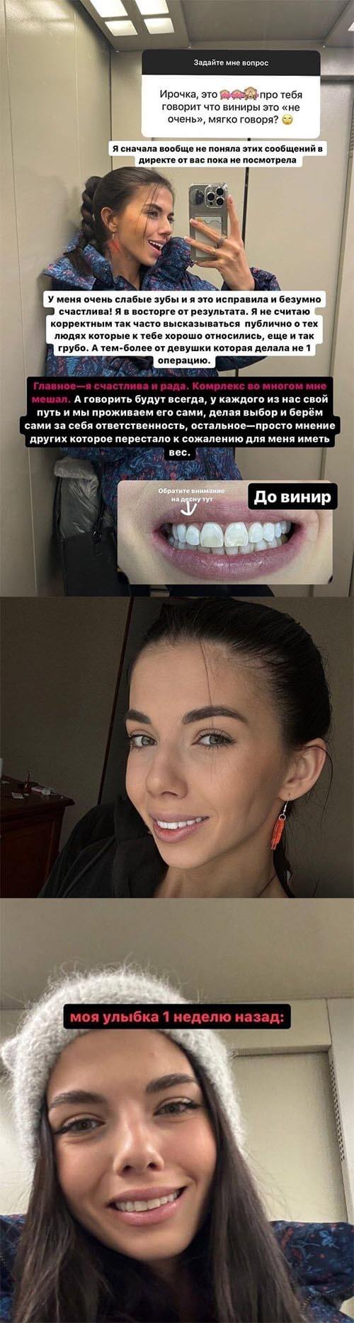 Сторис Ирины Пингвиновой вконтакте 
