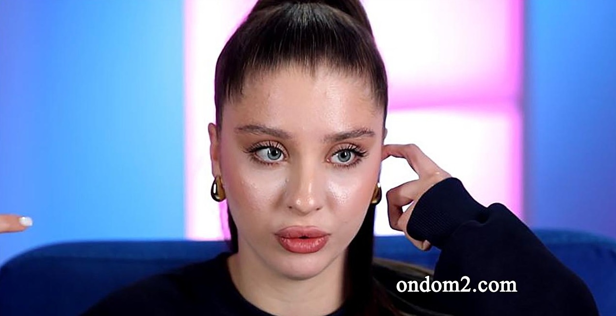 Катя Квашникова изуродовала себя уколами красоты  фото