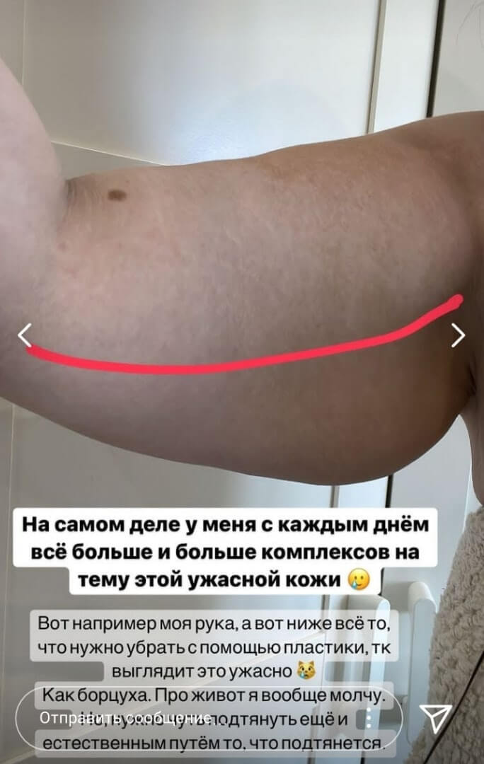 Фото обвисшей кожи Александры Черно Фото обвисшей кожи Александры Черно