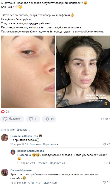 Голд до и после пластики