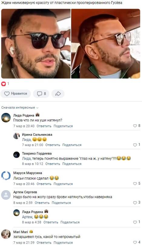Фото Антона Гусева после пластики вконтакте