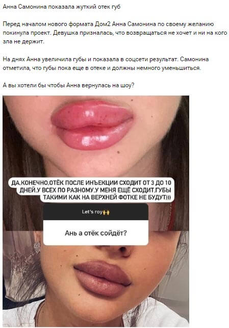 Фото накачанных губ Анны Самониной вконтакте
