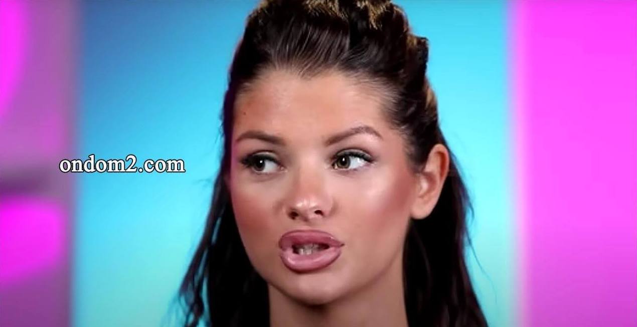 Первым делом Анна Самонина сделала новые губы  видео