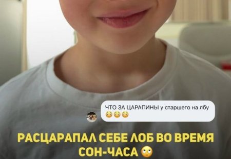 Первого мая 2026 года Кристина Ослина опубликовала фото старшего сына, вызвав волну удивления из-за тревожных следов на его лбу.