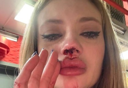 22 февраля 2026 года экс-участница "Дома-2" Ксения Карпова опубликовала тревожные кадры.