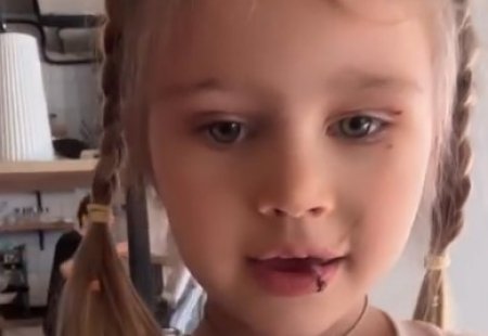 11 марта 2026 года дочь Ксении Задойновой получила травму лица, потребовавшую наложения швов.