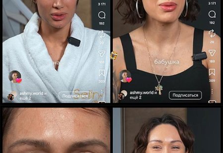 Алена Ашмарина 17 апреля 2026 года представила видеоматериал с результатами недавней пластической операции, который вызвал бурное обсуждение из-за заметных и, по мнению многих, спорных изменений во внешности.