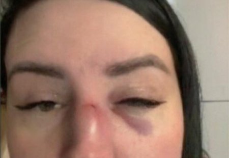 Десятого апреля 2024 года, в ходе очередной увеселительной ночи, Александра Черно, бывшая участница «Дома-2», подверглась жестокому нападению.