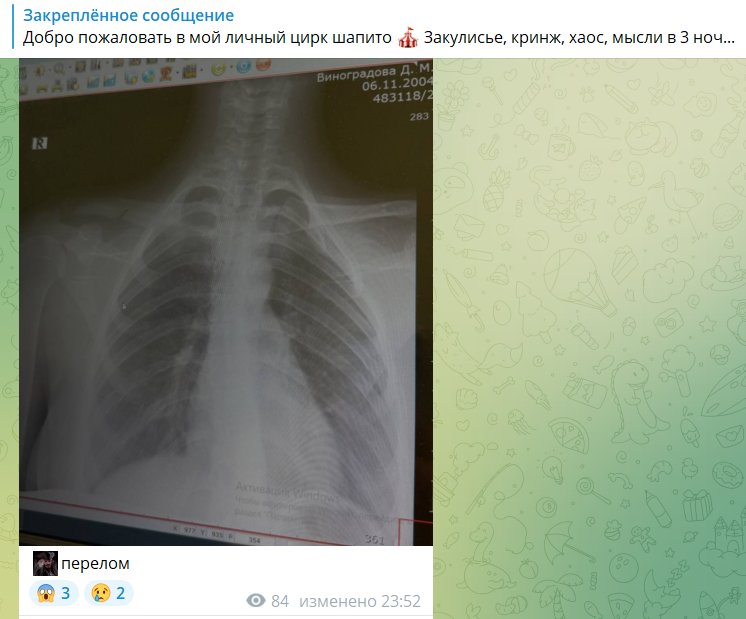 Вчерашний день ознаменовался интересным событием: Иван Китаев, проявив симпатию к Даше Виноградовой, опубликовал сообщение в социальных сетях, что привело к их приглашению на свидание. Сама Даша, заметив этот знак внимания к себе, посетила его профиль.