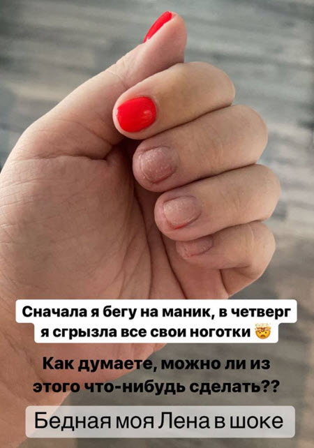 Александра Чepнo посетила пластического хирурга