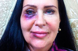 Кристина Лясковец напала на Татьяну Африкантову?