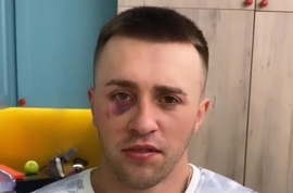 Новенький Павел показывает тяжелые последствия драки с Барзиковым.